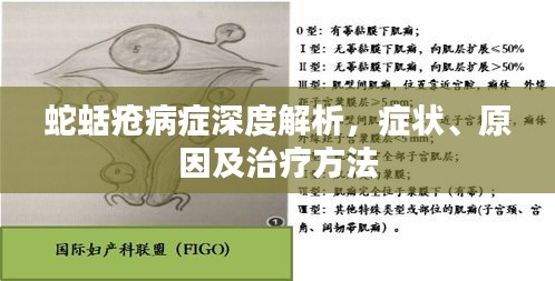 蛇蛞疮病症深度解析,症状、原因及治疗方法