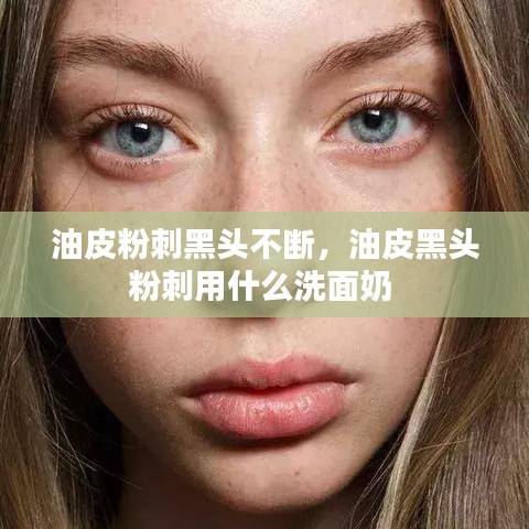 油皮粉刺黑头不断，油皮黑头粉刺用什么洗面奶 